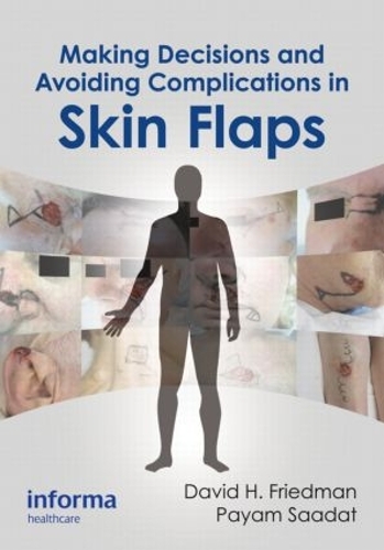 Бумажная книга «Making Decisions and Avoiding Complications in Skin Flaps» - фото №1