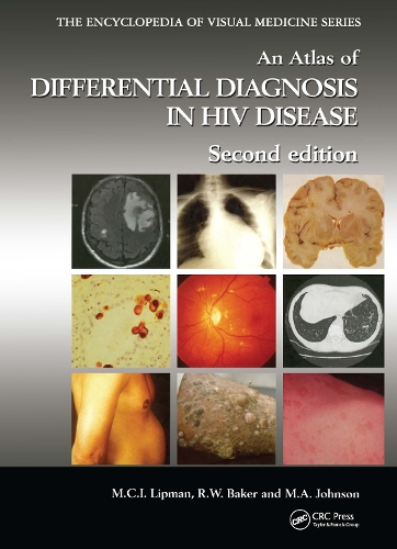 Бумажная книга «An Atlas of Differential Diagnosis in HIV Disease» - фото №1