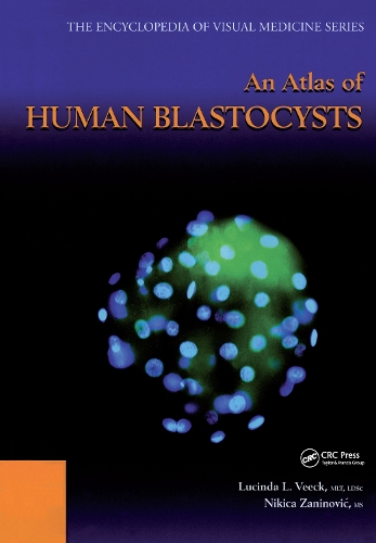Бумажная книга «An Atlas of Human Blastocysts», авторов Люсинда Л. Вик, Никита Занинович - фото №1