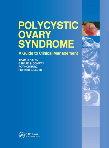 Паперова книга «Polycystic Ovary Syndrome: A Guide to Clinical Management» - фото №1
