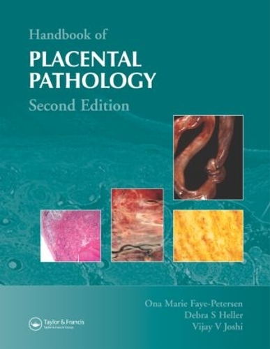 Паперова книга «Handbook of Placental Pathology», авторів Дебра С. Геллер, Она Марі Фей-Пітерсен, Віджай В. Джоші - фото №1