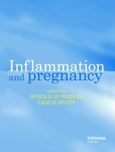 Паперова книга «Inflammation and Pregnancy» - фото №1