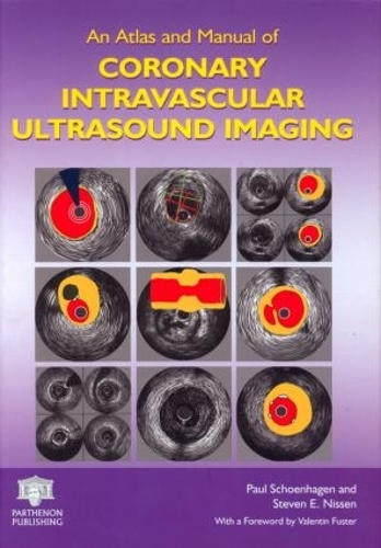 Бумажная книга «An Atlas and Manual of Coronary Intravascular Ultrasound Imaging» - фото №1