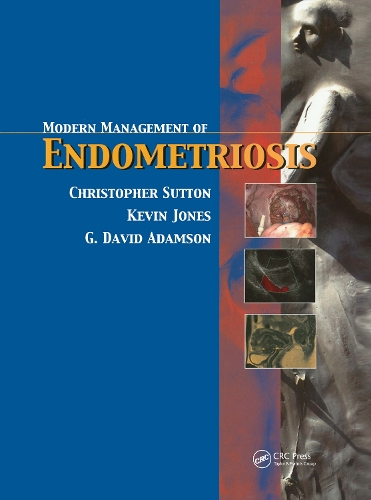 Паперова книга «Modern Management of Endometriosis» - фото №1