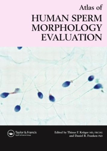 Паперова книга «Atlas of Human Sperm Morphology Evaluation» - фото №1