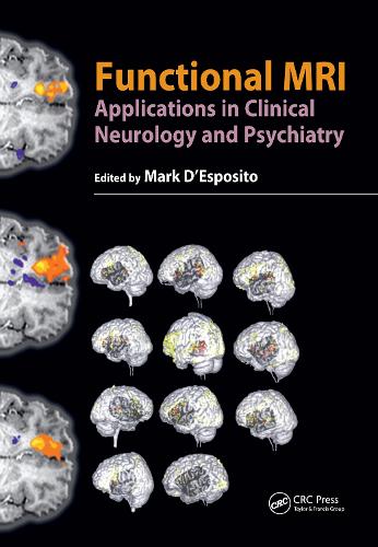Бумажная книга «Functional MRI: Applications in Clinical Neurology and Psychiatry» - фото №1