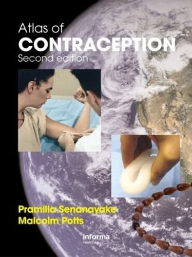 Бумажная книга «Atlas of Contraception», авторов Малкольм Поттс, Прамилла Сенанаяке - фото №1