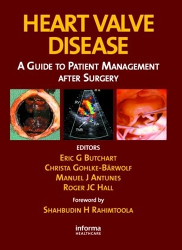 Паперова книга «Heart Valve Disease: A Guide to Patient Management After Surgery» - фото №1