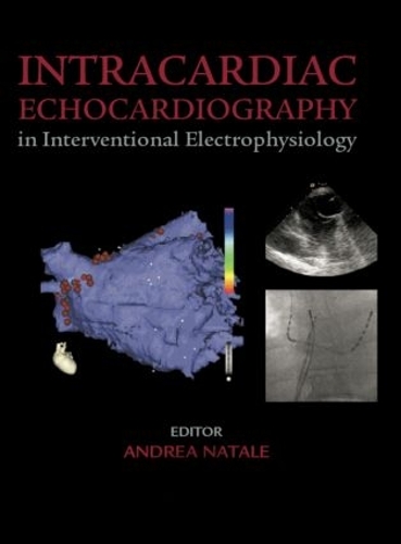 Бумажная книга «Intracardiac Echocardiography in Interventional Electrophysiology: Advanced Management of Atrial Fibrillation and Ventricular Tachycardia» - фото №1