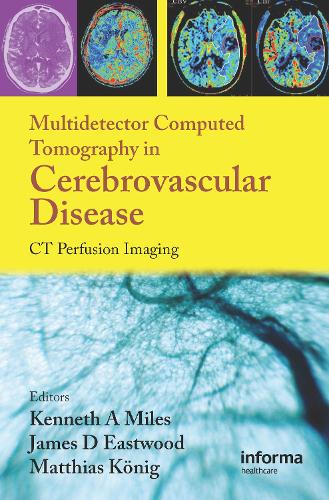 Бумажная книга «Multidetector Computed Tomography in Cerebrovascular Disease: CT Perfusion Imaging» - фото №1