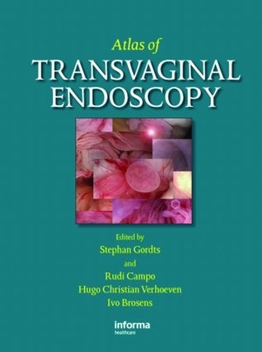 Паперова книга «Atlas of Transvaginal Endoscopy» - фото №1