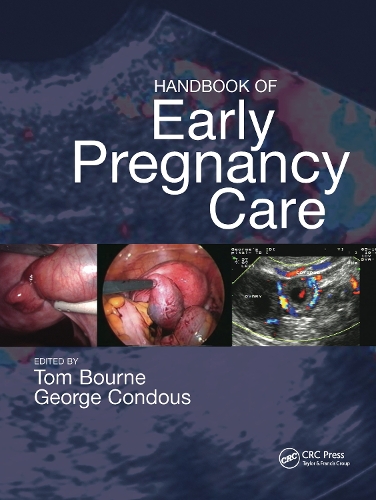 Паперова книга «Handbook of Early Pregnancy Care» - фото №1