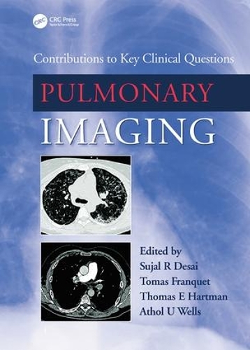 Паперова книга «Pulmonary Imaging: Contributions to Key Clinical Questions», авторів Атол Уеллс, Суджал Десаї, Томас Е. Хартман, Томас Франке - фото №1