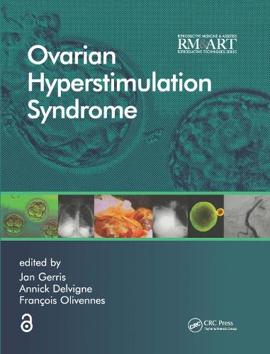 Паперова книга «Ovarian Hyperstimulation Syndrome» - фото №1