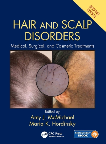 Бумажная книга «Hair and Scalp Disorders: Medical, Surgical, and Cosmetic Treatments, Second Edition» - фото №1