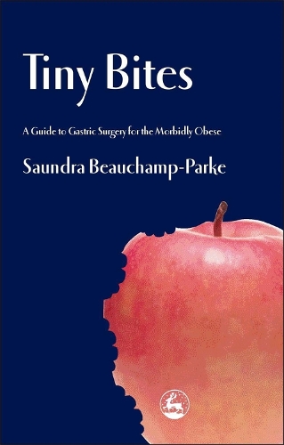 Бумажная книга «Tiny Bites: A Guide to Gastric Surgery for the Morbidly Obese», автор Сондра Бошамп-Парк - фото №1