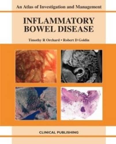 Бумажная книга «Inflammatory Bowel Disease», авторов Гораций Уильямс, Пэрис Теккис, Роб Голдин, Тимоти Р. Орчард - фото №1