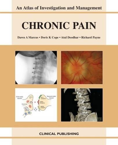 Паперова книга «Chronic Pain», авторів A. Деодхар, Доун A. Маркус, Доріс К. Коуп, Р. Пейн - фото №1