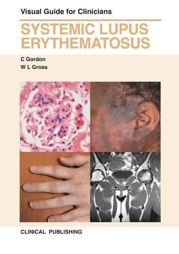 Бумажная книга «Systemic Lupus Erythematosus: Visual Guide for Clinicians», авторов К. Гордон, У. Л. Гросс - фото №1