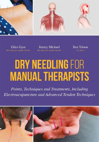Бумажная книга «Dry Needling for Manual Therapists: Points, Techniques and Treatments, Including Electroacupuncture and Advanced Tendon Techniques», авторов Бен Толсон, Джайлс Джайер, Джимми Майкл - фото №1