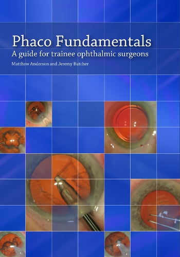 Бумажная книга «Phaco Fundamentals: A Guide for Trainee Ophthalmic Surgeons», авторов Джереми Батчер, Мэтью Андерсон - фото №1