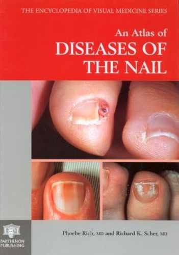 Паперова книга «An Atlas of Diseases of the Nail», авторів Фібі Річ, Річард К. Шер - фото №1