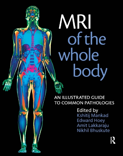 Бумажная книга «MRI of the Whole Body: An Illustrated Guide for Common Pathologies», авторов Амит Лаккараджу, Эдвард Хоуи, Кшитидж Манкад, Нихил Бхускуте - фото №1