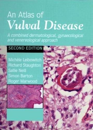 Бумажная книга «An Atlas of Vulval Diseases: A Combined Dermatological, Gynaecological and Venereological Approach», авторов Мишель Лейбович, Ричард Стаутон, Роджер Марвуд, Сэлли Нилл, Саймон Бартон - фото №1