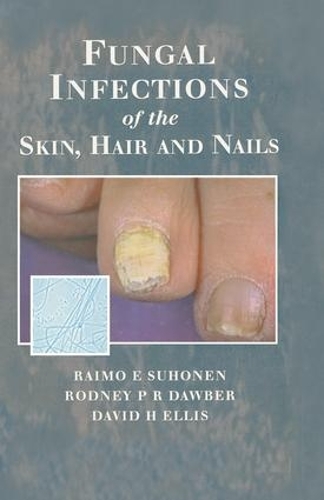 Бумажная книга «Fungal Infections of the Skin and Nails», авторов Дэвид Х. Эллис, Раймо Э. Сухонен, Родни П.Р. Доубер - фото №1