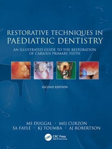 Бумажная книга «Restorative Techniques in Paediatric Dentistry: An Illustrated Guide to the Restoration of Extensive Carious Primary Teeth» - фото №1
