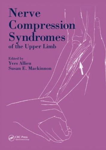 Бумажная книга «Nerve Compression Syndromes of the Upper Limb», авторов Сьюзен Э. Макиннон, Ив Алье - фото №1