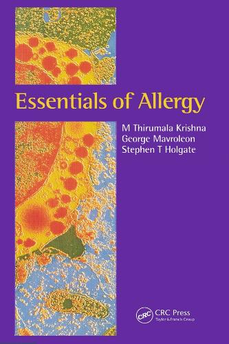 Бумажная книга «Essentials of Allergy», авторов Джордж Мавролеон, М Тирумала Кришна, Стивен Т. Холгейт - фото №1