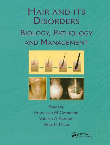 Бумажная книга «Hair and Its Disorders: Biology, Pathology and Management», авторов Франсиско М. Камачо, Валери А. Рэндалл, Вера Х. Прайс - фото №1