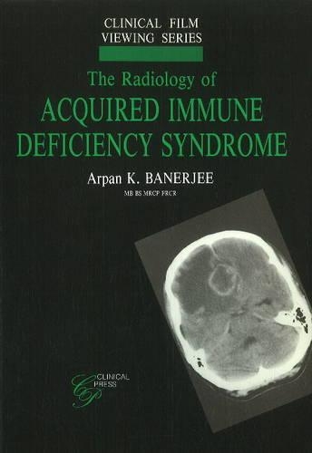 Паперова книга «Radiology of Acquired Immune Deficiency Syndrome», автор Арпан К. Банерджі - фото №1