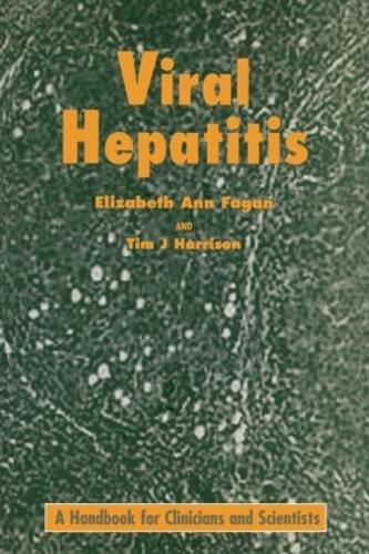 Паперова книга «Viral Hepatitis», авторів Е.А. Фаган, Т.Дж. Харісон - фото №1