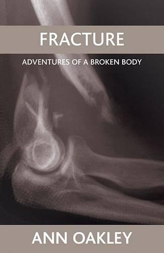 Бумажная книга «Fracture: Adventures of a broken body», автор Энн Окли - фото №1