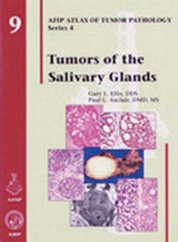 Бумажная книга «Tumors of the Salivary Glands», авторов Гэри Л. Эллис, Пол Л. Оклер - фото №1