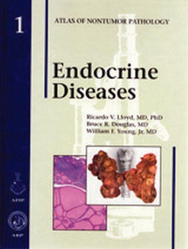 Бумажная книга «Endocrine Diseases», авторов Брюс Р. Дуглас, Рикардо В. Ллойд, Уильям Ф. Янг младший - фото №1