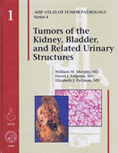 Паперова книга «Tumors of the Kidney, Bladder, and Related Urinary Structures», авторів Девід Дж. Гріньйон, Елізабет Дж. Перлман, Вільям М. Мерфі - фото №1