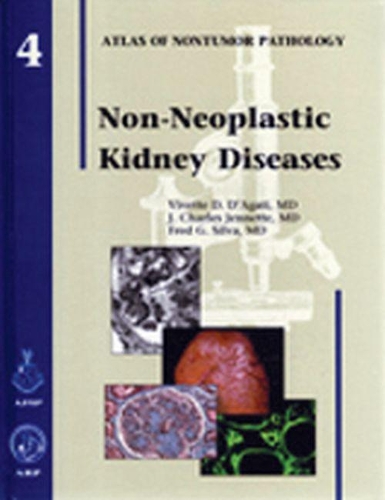 Паперова книга «Non-Neoplastic Kidney Diseases», авторів Фред Г. Сілва, Дж. Чарльз Дженнетт, Віветт Д. Д'Агаті - фото №1