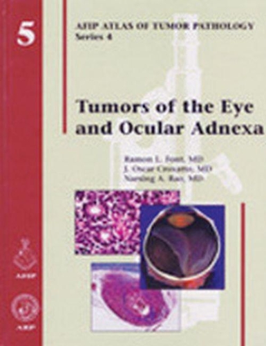 Бумажная книга «Tumors of the Eye and Ocular Adnexa», авторов Дж. Оскар Кроксатто, Нарсинг А. Рао, Рамон Л. Фонт - фото №1