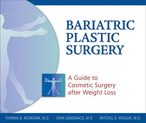Паперова книга «Bariatric Plastic Surgery: A Guide to Cosmetic Surgery After Weight Loss», авторів Джон ЛоМонако, Мітчел Д. Крігер, Томас Б. Макнемар - фото №1
