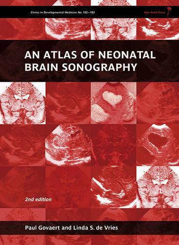 Паперова книга «An Atlas of Neonatal Brain Sonography», авторів Лінда С. де Вріс, Пол Говарт - фото №1