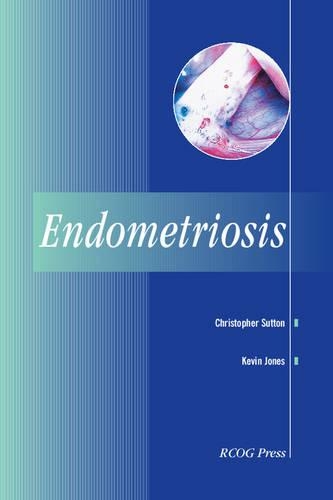 Бумажная книга «Endometriosis», автор Кевин Джонс - фото №1
