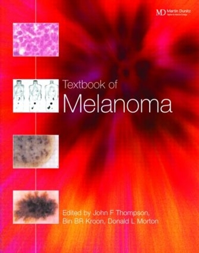 Бумажная книга «Textbook of Melanoma: Pathology, Diagnosis and Management» - фото №1