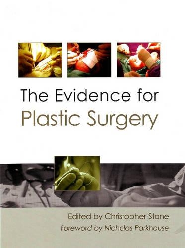 Бумажная книга «Evidence for Plastic Surgery», автор Кристофер Стоун - фото №1