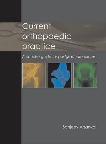 Паперова книга «Current Orthopaedic Practice: A concise guide for postgraduate exams», автор Санджив Агарвал - фото №1