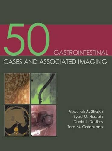 Паперова книга «50 Gastrointestinal Cases and Associated Imaging», авторів Абдулла А. Шейх, Девід Дж. Дезілетс, Саїд М. Хусейн, Тара М. Катандзано - фото №1