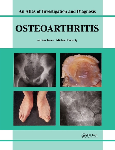 Бумажная книга «Oesteoarthritis: An Atlas of Investigation and Diagnosis», авторов Адриан Джонс, Майкл Доэрти - фото №1
