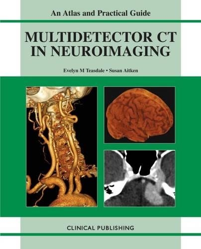 Бумажная книга «Multidetector CT in Neuroimaging», авторов Эвелин Тисдейл, Сьюзен Эйткен - фото №1
